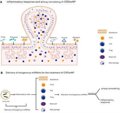 Research advances in roles of microRNAs in nasal polyp